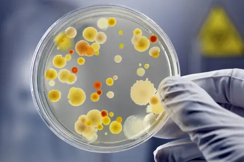 Kolonie bakterii na szalce Petriego, badane w laboratorium. To może być początek badań nad nowym probiotyk lek.