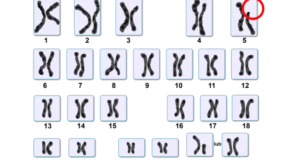 Kariotyp człowieka: 22 pary autosomów i jedna para chromosomów płci (XX lub XY). Ile człowiek ma chromosomów? 46.