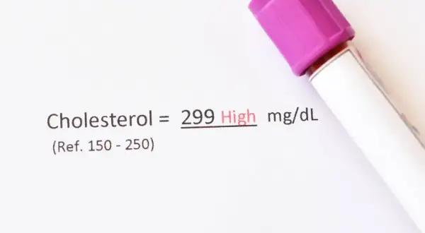 Wynik cholesterolu 299 mg/dL, co oznacza wysoki poziom. To może być sygnał, by przyjrzeć się diecie i rozważyć ezehron.