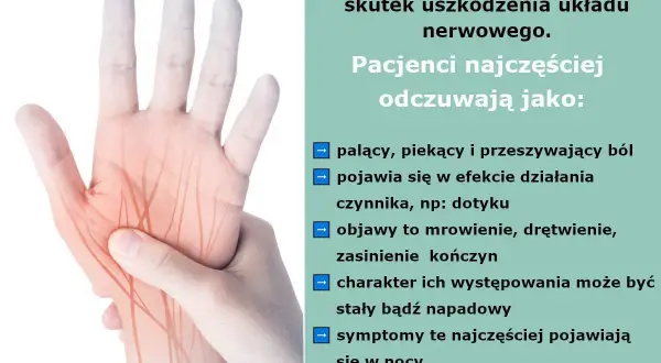Dłoń z zaznaczonymi nerwami, ilustrująca ból neuropatyczny. Odczuwany jako palący, piekący, z mrowieniem i drętwieniem.