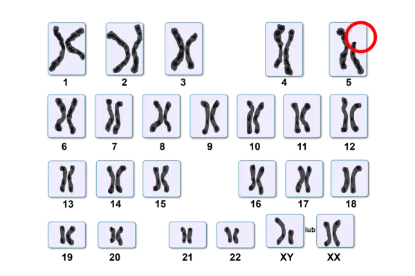 Kariotyp człowieka: 22 pary autosomów i jedna para chromosomów płci (XX lub XY). Ile człowiek ma chromosomów? 46.