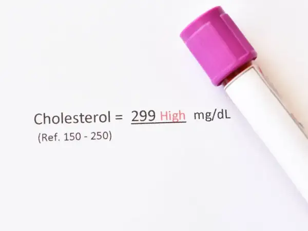 Wynik cholesterolu 299 mg/dL, co oznacza wysoki poziom. To może być sygnał, by przyjrzeć się diecie i rozważyć ezehron.