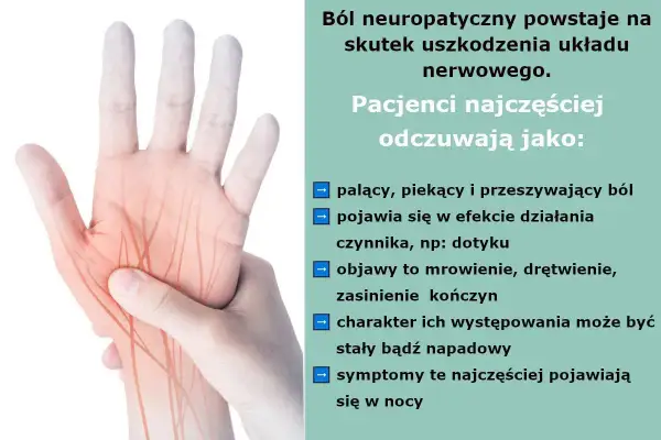 Dłoń z zaznaczonymi nerwami, ilustrująca ból neuropatyczny. Odczuwany jako palący, piekący, z mrowieniem i drętwieniem.
